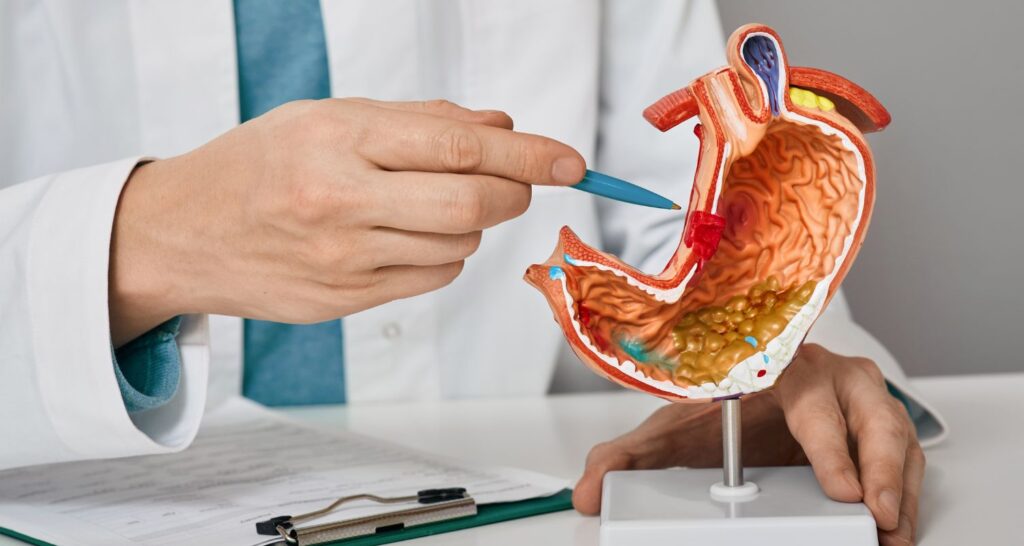 Dalla Dispepsia al Morbo di Crohn