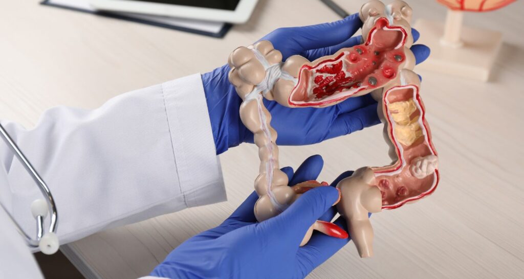 Il Tuo Percorso verso una Digestione Serena: Dalla Diagnosi alla Terapia con il Gastroenterologo